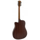 TONEBERG TQ-BC-FGS